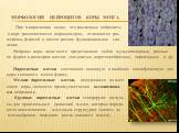 Морфология нейроцитов коры мозга. При микроскопии видно, что различные нейроциты в коре располагаются неравномерно, отличаются раз- мерами, формой и имеют разное функциональное зна- чение. Нейроны коры чаще всего представляют собой мультиполярные, разные по форме и размерам клетки: звездчатые, верет