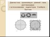 Диагностика проникающих ранений глаза рентгенография с использованием индикаторов Комберга - Балтина