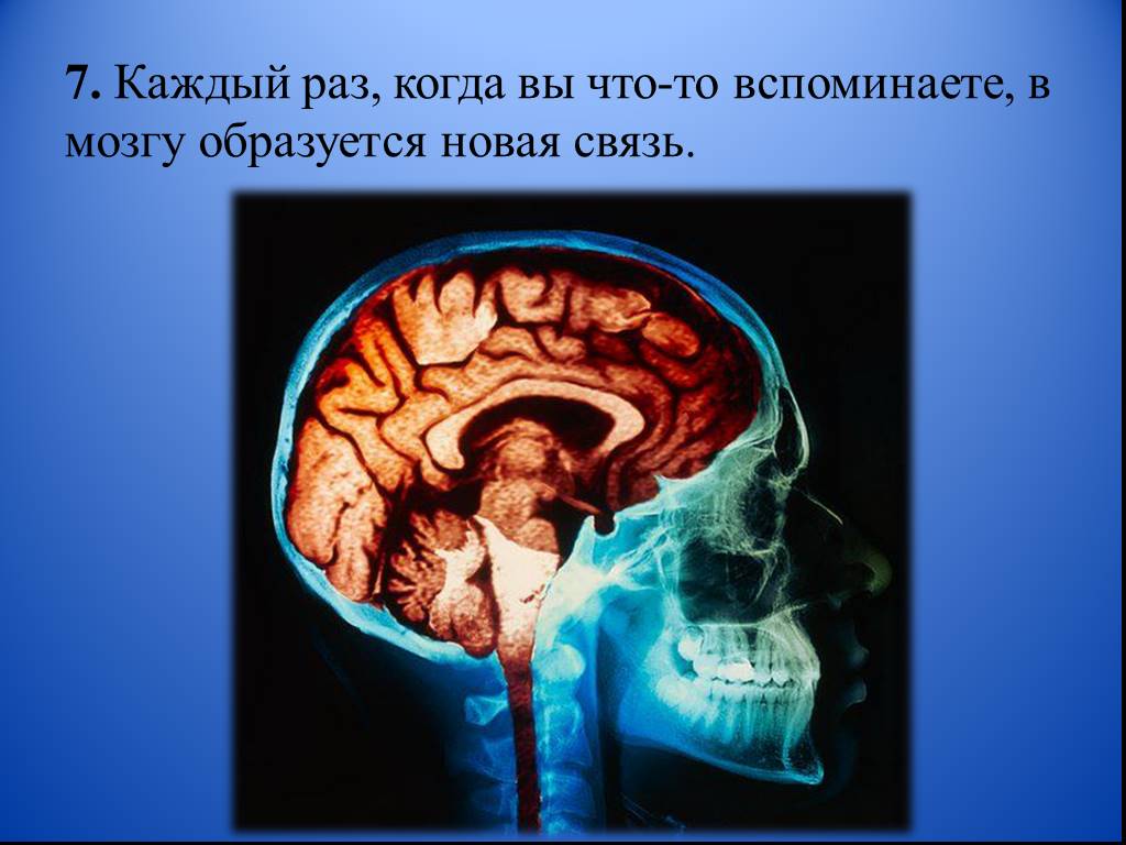 Как появился мозг. Интересные факты о головном мозге. Факты о человеческом мозге. Интересные факты о головном мозге проект. Интересные факты про мозг 2 класс.