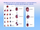 Морфология клеток гранулоцитарного, моноцитарного, лимфоидного ростков кроветворения (схема).