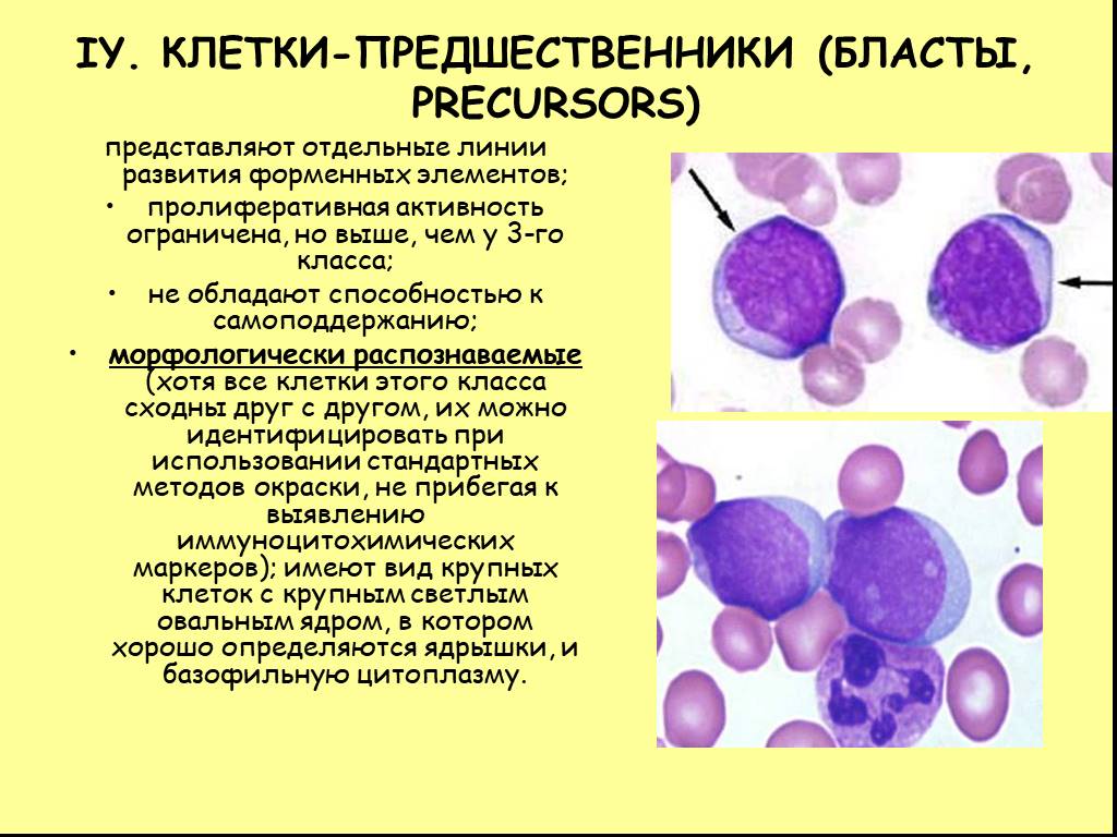 Бластные клетки. Клетки бласты. Клетки предшественники. Бластные клетки в крови. Бластные клетки характеризуются.