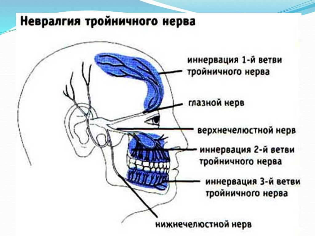 Как отличить зубную боль от тройничного. Невралгия 3 ветви тройничного нерва. 1 И 2 ветвь тройничного нерва. Невралгия второй ветви тройничного нерва. Невралгия первой ветви тройничного нерва симптомы.