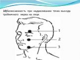 10)Болезненность при надавливании точек выхода тройничного нерва на лице.