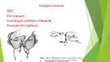 Хирургическое ПХО Репозиция Фиксация костных отломков Риносептопластика