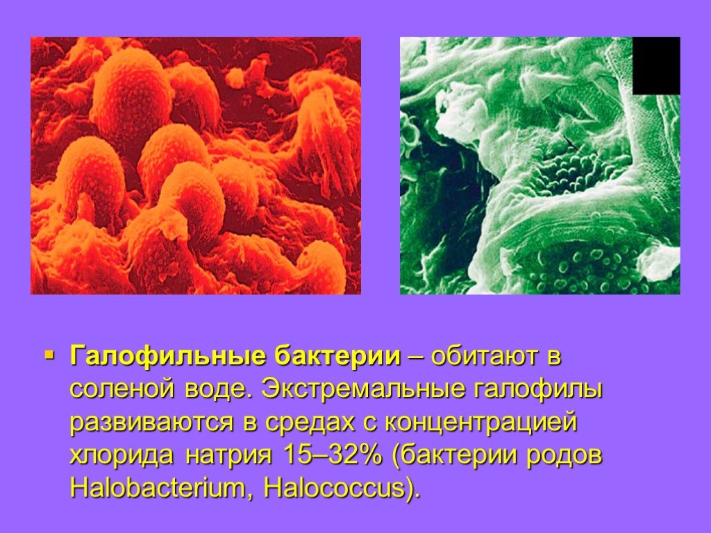 Бактерии в соленой воде. Галобактерии археи. Галофилы микробиология. Галофиты бактерии. Галофилы примеры микроорганизмов.
