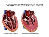 Сердечная мышечная ткань