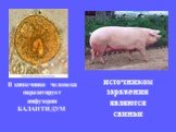 В кишечнике человека паразитирует инфузория БАЛАНТИДУМ. источником заражения являются свиньи
