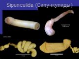 Sipunculida (Сипункулиды)