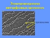 Электронограмма интерфазных хромосом. нуклеосомы