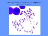 Дифференциальная окраска мметафазных хромосом по Гимза.