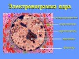 Электронограмма ядра. кариоплазма