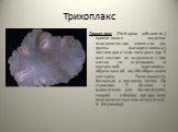 Трихоплакс. Трихоплакс (Trichoplax adhaerens), примитивное морское многоклеточное животное (из группы фагоцителлозоа), листовидное тело которого (до 3 мм) состоит из наружного слоя клеток со жгутиками и внутренней паренхимы, образованной амёбообразными клетками. Размножается бесполым и половым путём