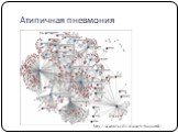 Атипичная пневмония. http://ai.arizona.edu/research/bioportal/