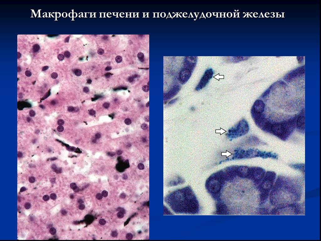 Макрофаги в тканях. Макрофаги соединительной ткани. Макрофаги гистология. Печеночные макрофаги. Соединительная ткань в поджелудочной железе.