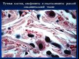 Тучные клетки, лимфоциты и эндотелиоциты рыхлой соединительной ткани