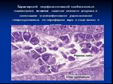 Характерной морфологической особенностью плазмоцитов является наличие светлого дворика в цитоплазме и специфическое расположение гетерохроматина по периферии ядра в виде «спиц в колесе»