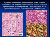 В плотной волокнистой соединительной ткани волокна преобладают над аморфным компонентом, причём в плотной неоформленной они располагаются неупорядоченно (Г.-э.; Пикросириус-орсеин; Поляризационная микроскопия)