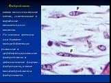 Фибробласты. самые многочисленные клетки, участвующие в выработке межклеточного вещества. По степени зрелости они бывают: малодифференци- рованные и дифференцированные фибробласты и дефинитивные формы – фиброциты, а также миофибробласты и фиброкласты.