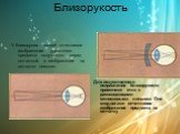 Близорукость. У близоруких людей отчетливое изображение удаленного предмета получается перед сетчаткой, а изображение на сетчатке неясное. Для искусственного исправления близорукости применяют очки с рассеивающими менисковыми линзами. Они отодвигают отчетливое изображение предмета на сетчатку