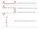 Разграничительная линия между дивизиями. Разграничительная линия между батальонами. Разграничительная линия между полками. Общее обозначение ближайшей задачи батальона