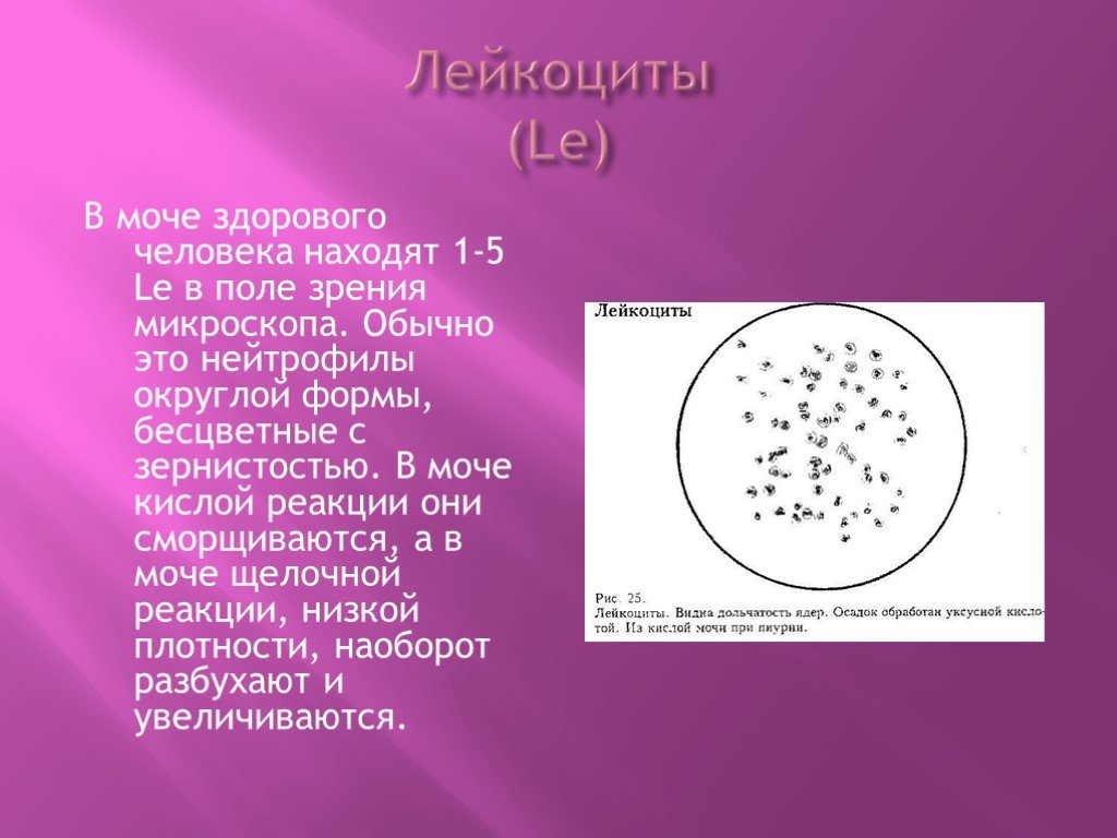Лейкоциты в моче заболевания. Лейкоциты в моче 1/2 поля зрения. Лейкоциты в поле зрения в моче. Лейкоциты в моче микроскопия осадка. Лейкоциты и эритроциты в моче под микроскопом.