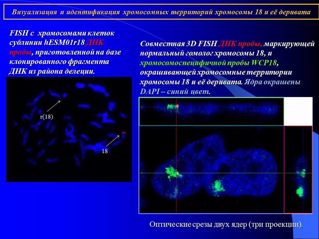 Днк 18. Хромосомные территории. Идентификация визуализация. Визуализация и идентификация фрагментов ДНК. Дериватная хромосома это.