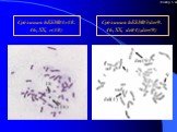 Дифференциальное окрашивание хромосом в аномальных ЭСК. Слайд 5 из 17