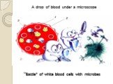 A drop of blood under a microscope. “Battle" of white blood cells with microbes