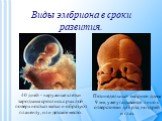 Пятинедельный эмбрион длина 9 мм, уже угадывается лицо с отверстиями для рта, ноздрей и глаз. 40 дней - наружные клетки зародыша срослись с рыхлой поверхностью матки и образуют плаценту, или детское место.