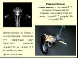 Радиоактивные компоненты - полоний-210, свинец-210 и калий-40. Помимо них присутствуют также радий-226, радий-228 и торий-228. Проведенные в Греции исследования показали, что табачный лист содержит изотопы цезий-134 и цезий-137 чернобыльского происхождения.
