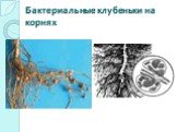 Бактериальные клубеньки на корнях
