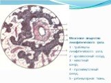 Мозговое вещество лимфатического узла. 1 - трабекулы лимфатического узла; 2 - кровеносный сосуд; 3 - мякотный шнур; 4 - промежуточный синус; 5 - ретикулярная ткань.