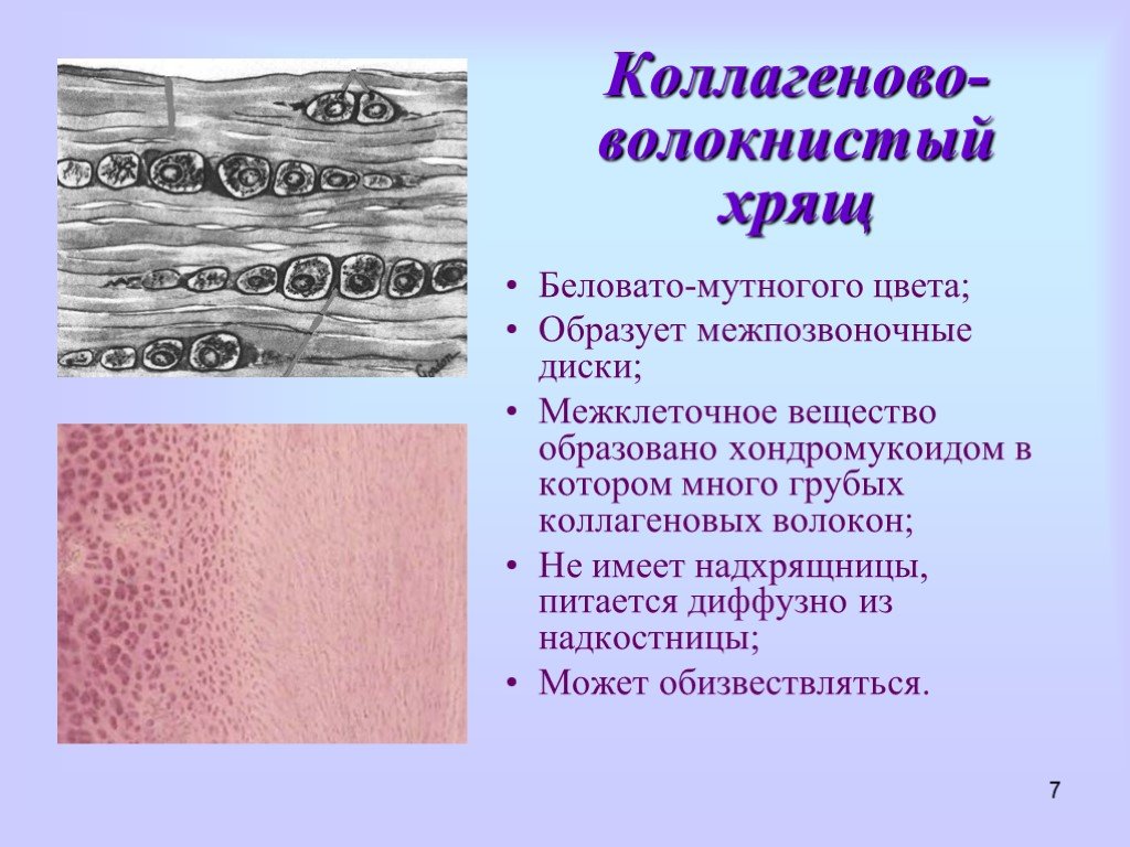 Хрящ образован. Коллагенвоволакнистый хрыщ препарат. Коллагено волокнистый хрящ. Межклеточное вещество волокнистого хряща. Коллагеново-волокнистый хрящ ткань.