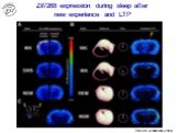 Zif/268 expression during sleep after new experience and LTP. Ribeiro & Nicolelis (2004)