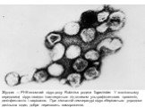 Збудник — РНК-геномний вірус роду Rubivirus родини Togaviridae. У зовнішньому середовищі вірус швидко інактивується під впливом ультрафіолетових променів, дезінфектантів і нагрівання. При кімнатній температурі вірус зберігається упродовж декількох годин, добре переносить замороження.
