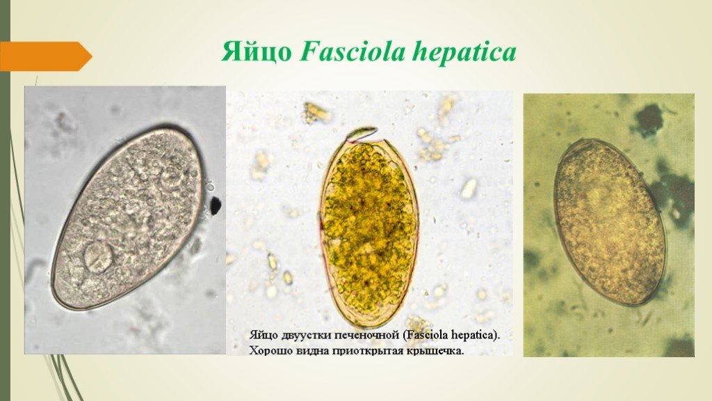 Печеночный сосальщик диагностика. Яйца печеночного сосальщика микроскоп. Яйцо гельминта фасциолез. Яйцо фасциолы строение. Fasciola hepatica яйца.