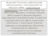 Выделяют плоскую лейкоплакию курильщиков с локализацией на твердом нёбе - лейкоплакия Таппейнера. При этом на слизистой оболочке твердого, а иногда мягкого нёба имеются явления нерезко выраженного паракератоза. Слизистая серовато-белого цвета, несколько уплотнена, с красными точками зияющих устьев в