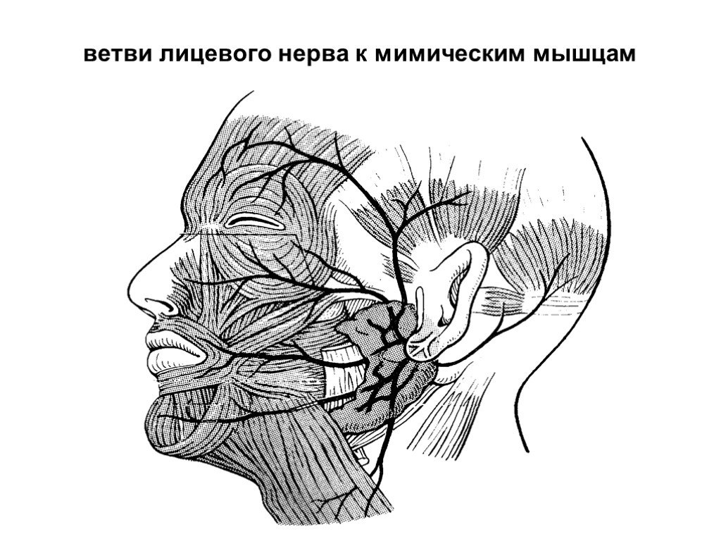 Лицевой нерв является. Перекрест лицевого нерва. Ветви лицевого нерва схема. Внеканальные ветви лицевого нерва. Ход лицевого нерва топографическая анатомия.