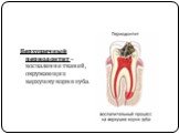 Верхушечный периодонтит – воспаление тканей, окружающих верхушку корня зуба.