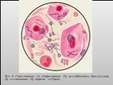 Рис. 6. Стрептококки (1), стафилококки (2), диплобактерии Фридлендера (3), пневмококки (4); окраска по Граму