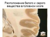 Расположение белого и серого вещества в головном мозге