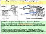 Другие гетероконты: Лабиртнтулиды – сетчатые слизевики с эктоплазматической сетью. Амебоидные организмы, имеющие уникальные органеллы – ботросомы (сагеногенетосомы), связаные с образованием тяжей цитоплазмы, лишенных органелл и клеточных стенок – эктоплазматической сети, играющей, по-видимому, основ
