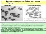 Другие гетероконты: Лабиртинтулиды класс Лабиринтулеи – обитатели эктоплазматических туннелей. Веретеновидные клетки находятся внутри каналов, образованных эктоплазматической сетью. Эктоплазматические трубки разных клеток сливаются, и образуется колония, где снабженные клеточной стенкой трофозоиты с