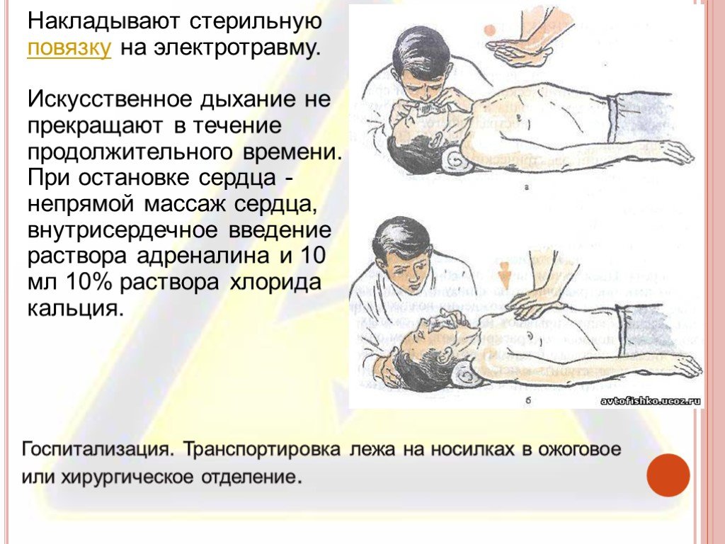 В каком случае прекращают. Непрямой массаж сердца электрическим током. Наружный массаж сердца при поражении электрическим. Искусственное дыхание и непрямой массаж сердца при поражении током. Непрямой массаж сердца при ударе током.