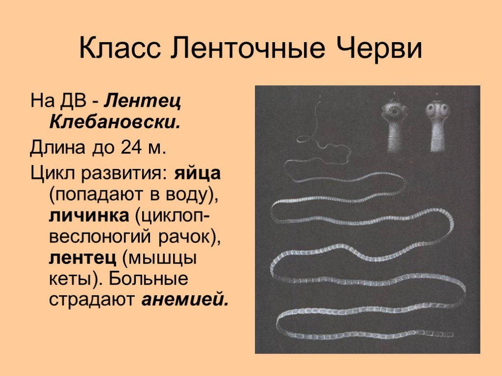 Про ленточных червей. Плоские ленточные черви биология 7 класс. Класс ленточные черви (Cestoda). Ленточные черви широкий лентец. Цестоды, ленточные глисты..