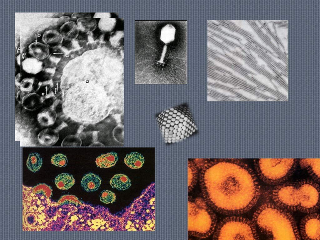 Формы вирусов. Вирусы неклеточные формы жизни. Неклеточные компоненты тканей. Неклеточные формы в микроскопе.