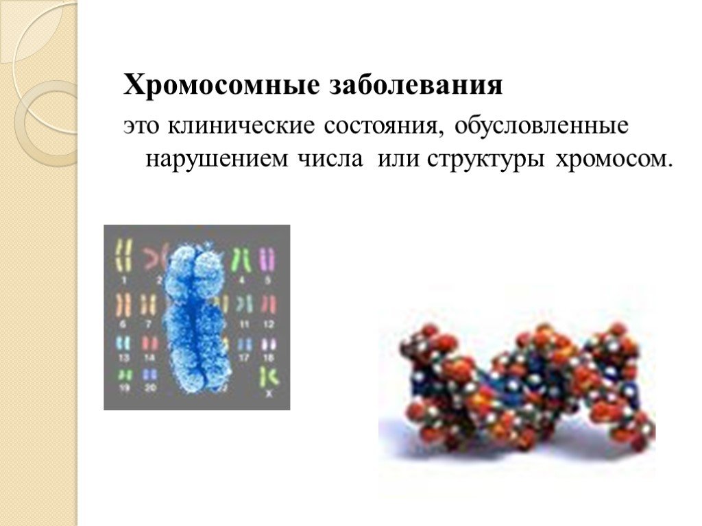 5 заболеваний хромосом. Хромосомные заболевания. Заболевания с нарушением строения хромосом. Заболевания связанные с нарушением структуры хромосом. Хромосомные заболевания презентация.