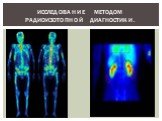 Исследование методом радиоизотопной диагностики.