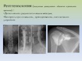 Рентгеноскопия (получение движущихся объектов в реальном времени) : Дополнение к радиологическим методам; Контроль при иньекциях, дренированиях, имплантации устройств