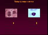 Типы тучных клеток